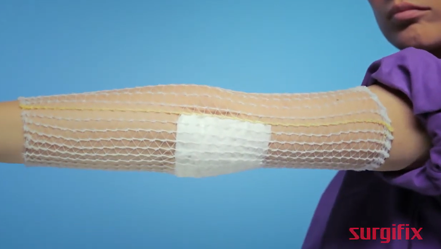 Elastne võrkside kätele Surgifix nr 3 (39 cm x 25 m)